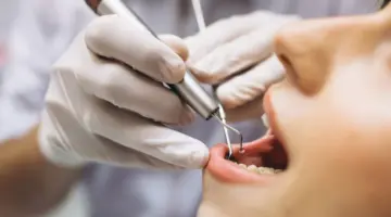 "وزارتا الموارد البشرية والصحة".. يعلنا بدء تنفيذ توطين مهنة طب الأسنان