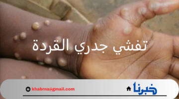 عاجل .. الطوارئ تحذر من تفشي جدري القردة في أفريقيا و مناطق متعددة