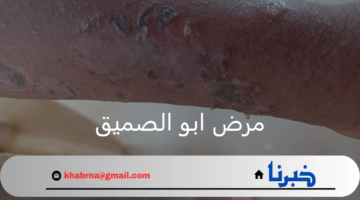 ما هو اعراض وأسباب التهاب الجلدي البكتيري أبو الصميق المنتشر في السودان؟