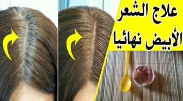 هترجعي شباب بأقل تكلفة.. كيفية التخلص من شيب الشعر بطريقة طبيعية