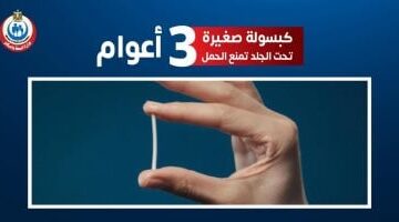 هل تعد "الكبسولة" وسيلة منع حمل آمنة؟.. استشارى نساء تجيب
