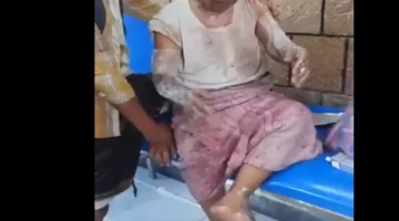 شاهد: إحراق بائع زلابيا المسن بالزيت في قلب إب.. صورة متداولة تثير غضب اليمنيين!