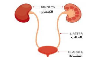طبيبة روسية تبرز 4 أخطاء شائعة في علاج التهاب المثانة بدءًا من التشخيص وصولًا إلى المضاد الحيوي