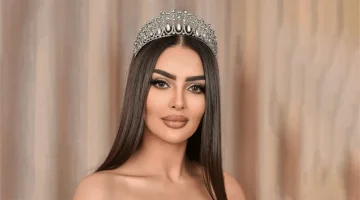 ملكة جمال السعودية رومي القحطاني تعلن عن تعرضها لإصابة في وجهها